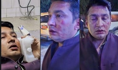 नमोबुद्ध नगरपालिकाको टिकट वितरण सम्बन्धी विवादमा कुटाकुट